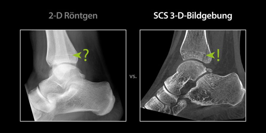 SCS Röntgenbilder