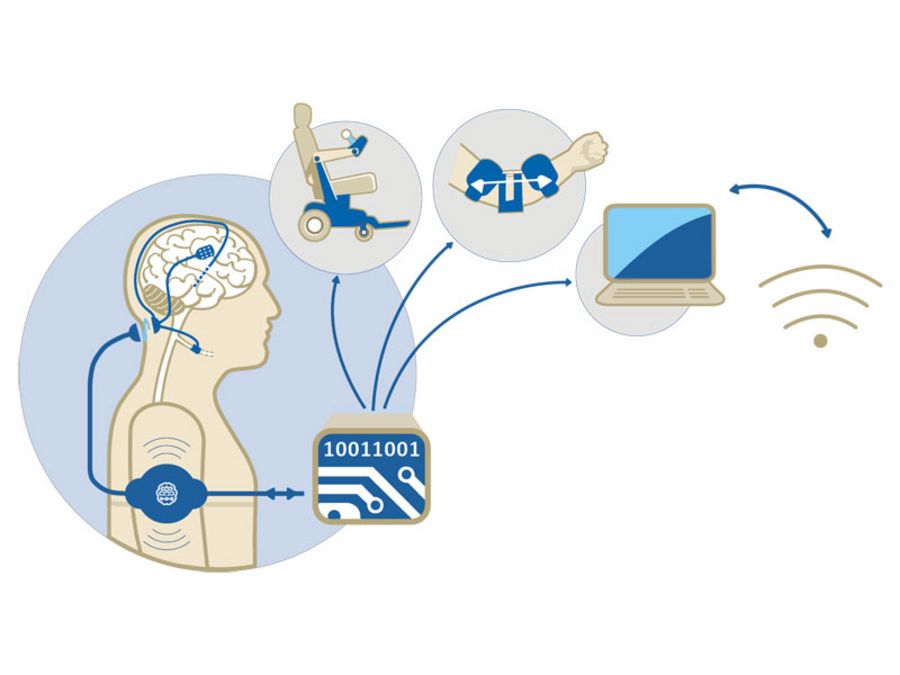 CorTec Funktionsmodell des Brain Interchange-Systems