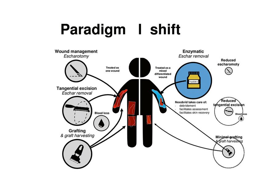 Mediwound Paradigmenwechsel