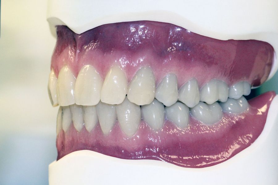 Lentz & Müller Dentaltechnik Prothese