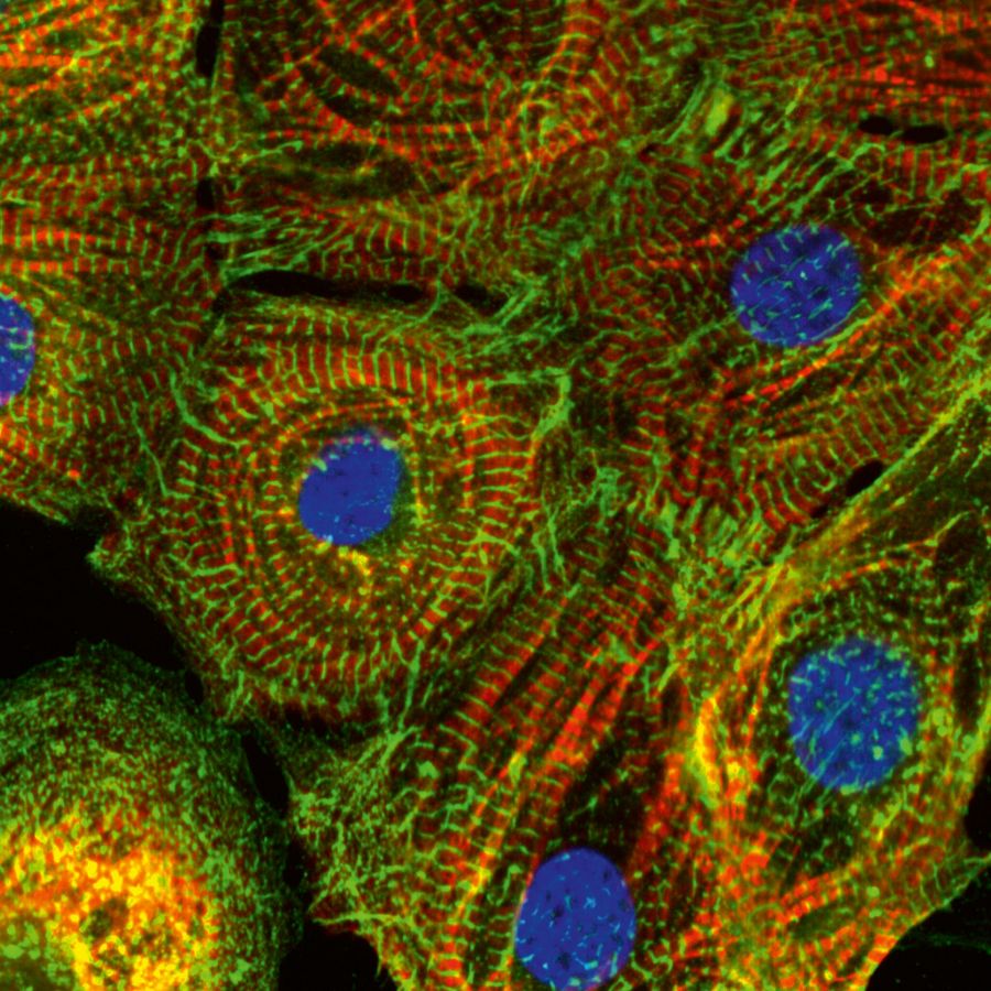 ibidi GmbH Fluoreszenzmikroskopie ibidi GmbH Fluoreszenzmikroskopie